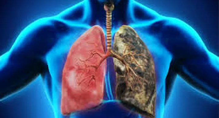 What Smoking Does To Lungs